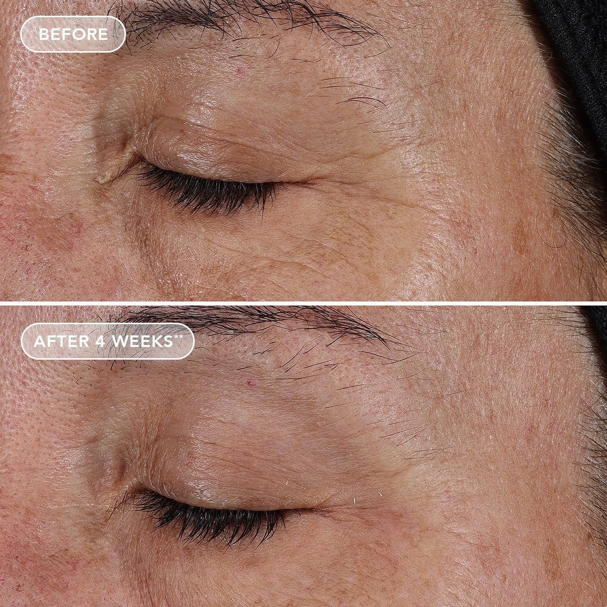 IMAGE AGELESS+ retinol pure liquid retinol 0.1%