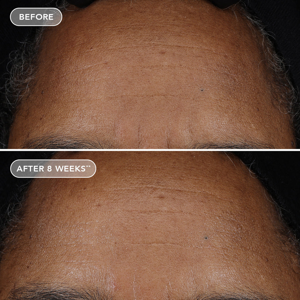 IMAGE AGELESS+ retinol pure liquid retinol 0.75%