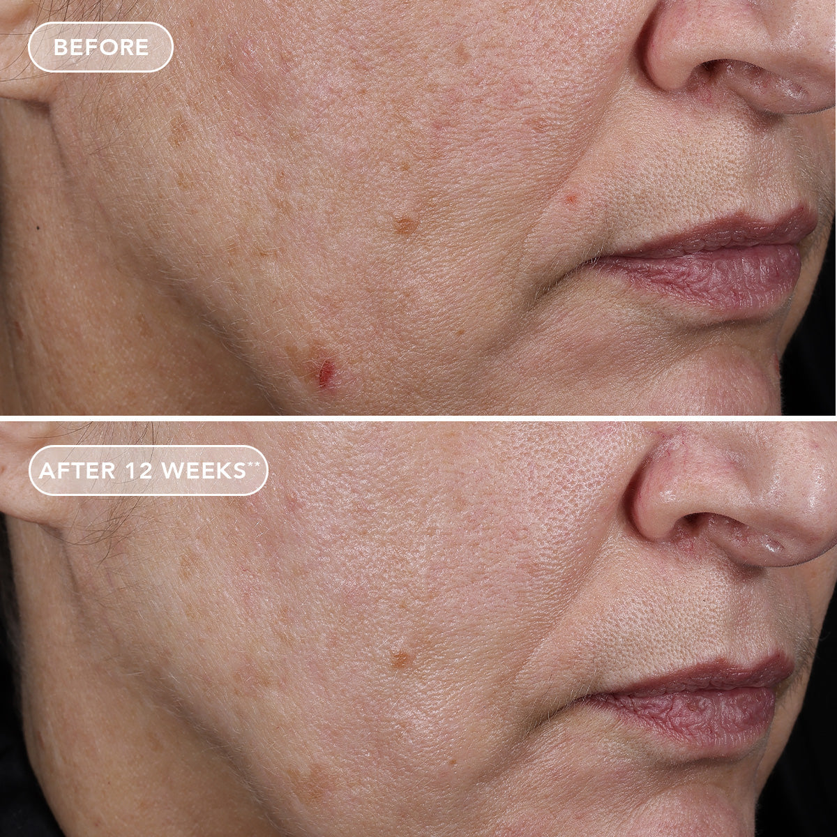 IMAGE AGELESS+ retinol pure liquid retinol 0.75% (travel size)