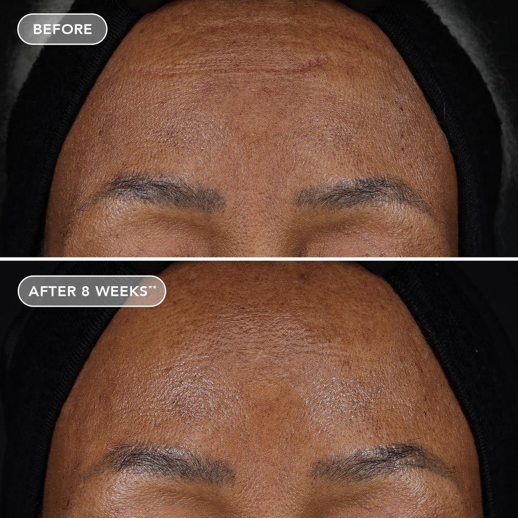 IMAGE AGELESS+ retinol treatment crème 1.2% retinol complex (travel size)