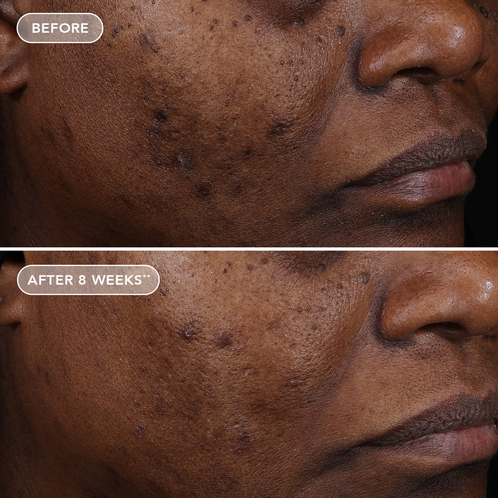 IMAGE AGELESS+ retinol treatment crème 1.2% retinol complex (travel size)