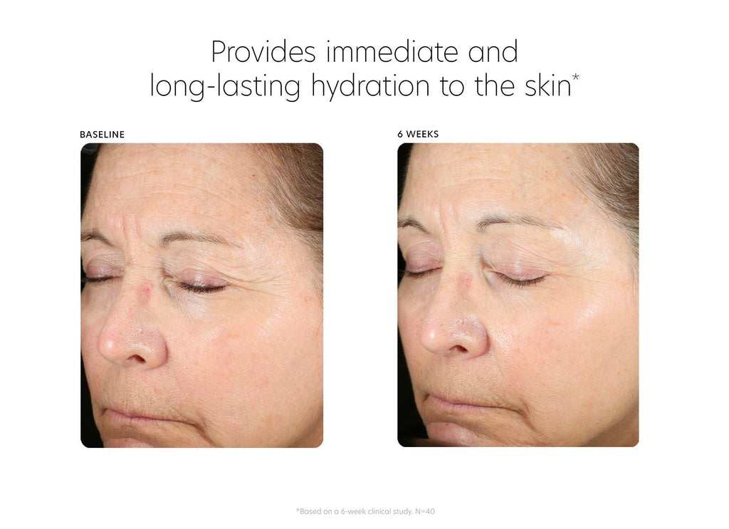 PCA Skin® Hyaluronic Acid Boosting Serum - 1fl oz