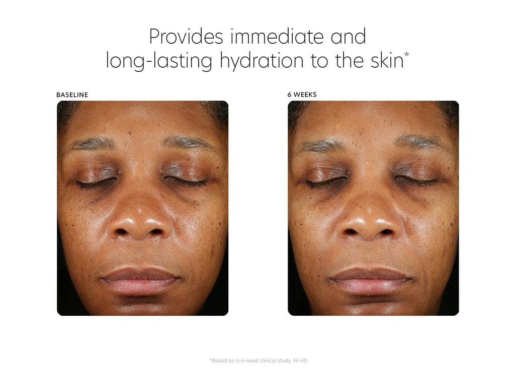 PCA Skin® Hyaluronic Acid Boosting Serum - 1fl oz