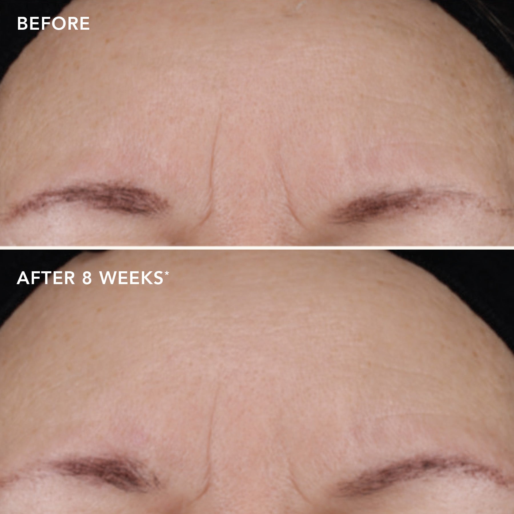 IMAGE AGELESS+ retinol treatment crème 1.2% retinol complex (travel size)